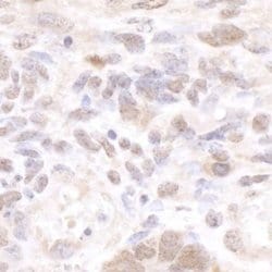 cleavage stimulation factor Antibody, Novus Biologicals 100 &mu;L | Buy Online | Novus Biologicals | Fisher Scientific